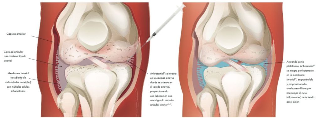 Imagen rodilla