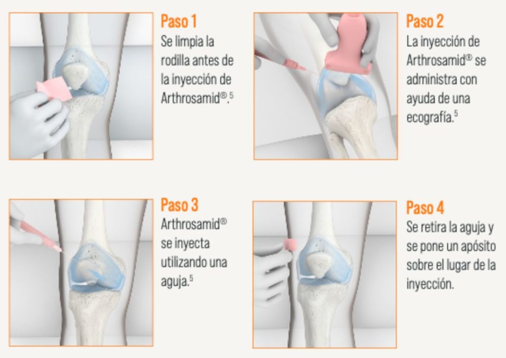 ¿Cómo se administra Arthrosamid®?